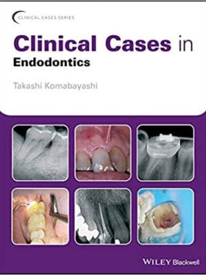 Clinical Cases in Endodontics – eBook PDF
