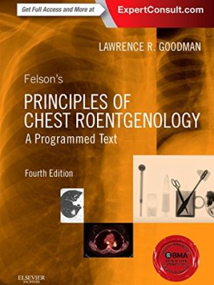 Felson’s Principles of Chest Roentgenology (4th Edition) – eBook